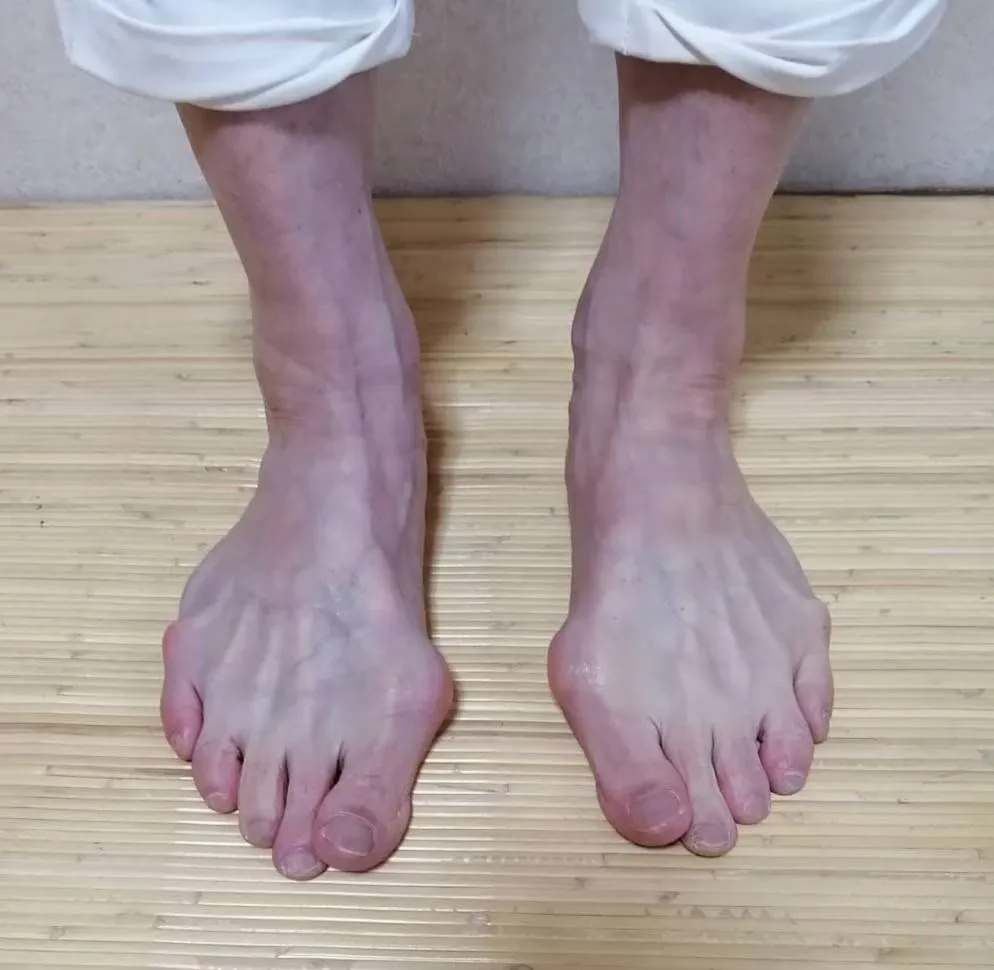 Sandals (blend in as soon as you put them on)